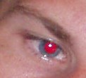 rote augen