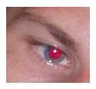 Preview Rote Augen entfernen